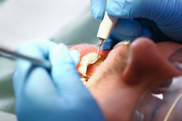Best Emergency Broken Tooth Repair in El Dorado Hills, CA