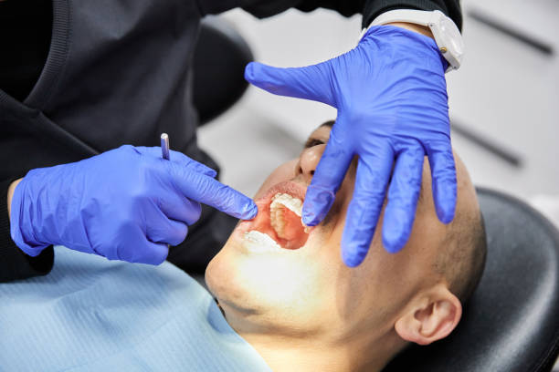 Best Emergency Root Canal Treatment in El Dorado Hills, CA