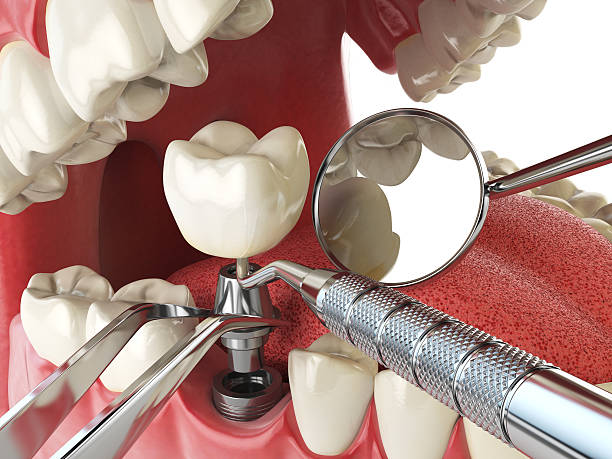 Best 24-Hour Emergency Dentist in El Dorado Hills, CA